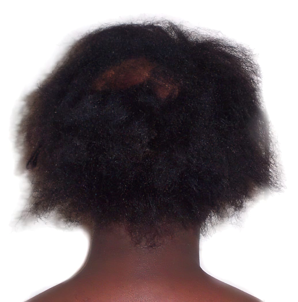 Before Picture - Afro-Caribbean Wavy